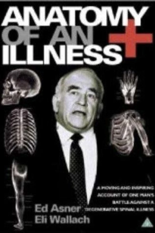 Anatomy of an Illness Plakat